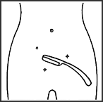 前列腺1.png