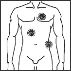 祛痛.png
