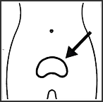 前列腺2.png